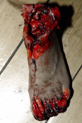 severed foot